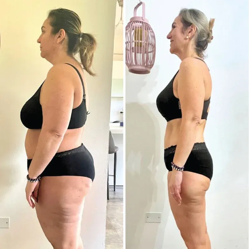 Photo shared by Firmthera customer Sofia