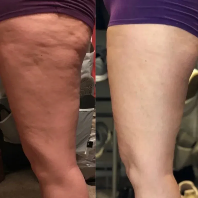 Photo shared by Firmthera customer Olivia